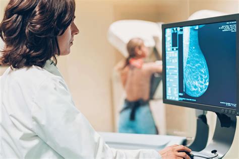 Mammography and .